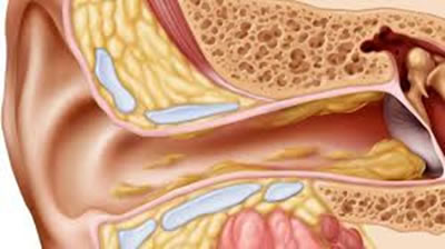 Microsuction