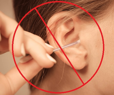 Microsuction